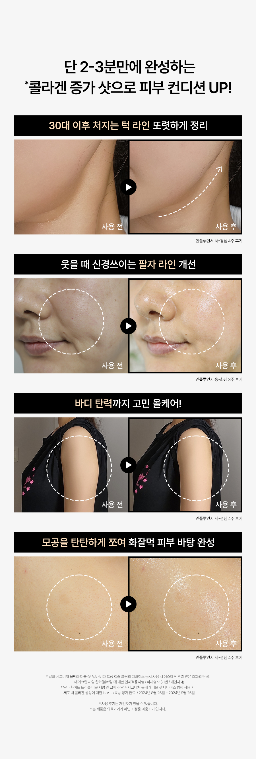 d'Alba Signature Allsera Double Shot LED Home Device - Korea's Viral K-Beauty Facial Tool